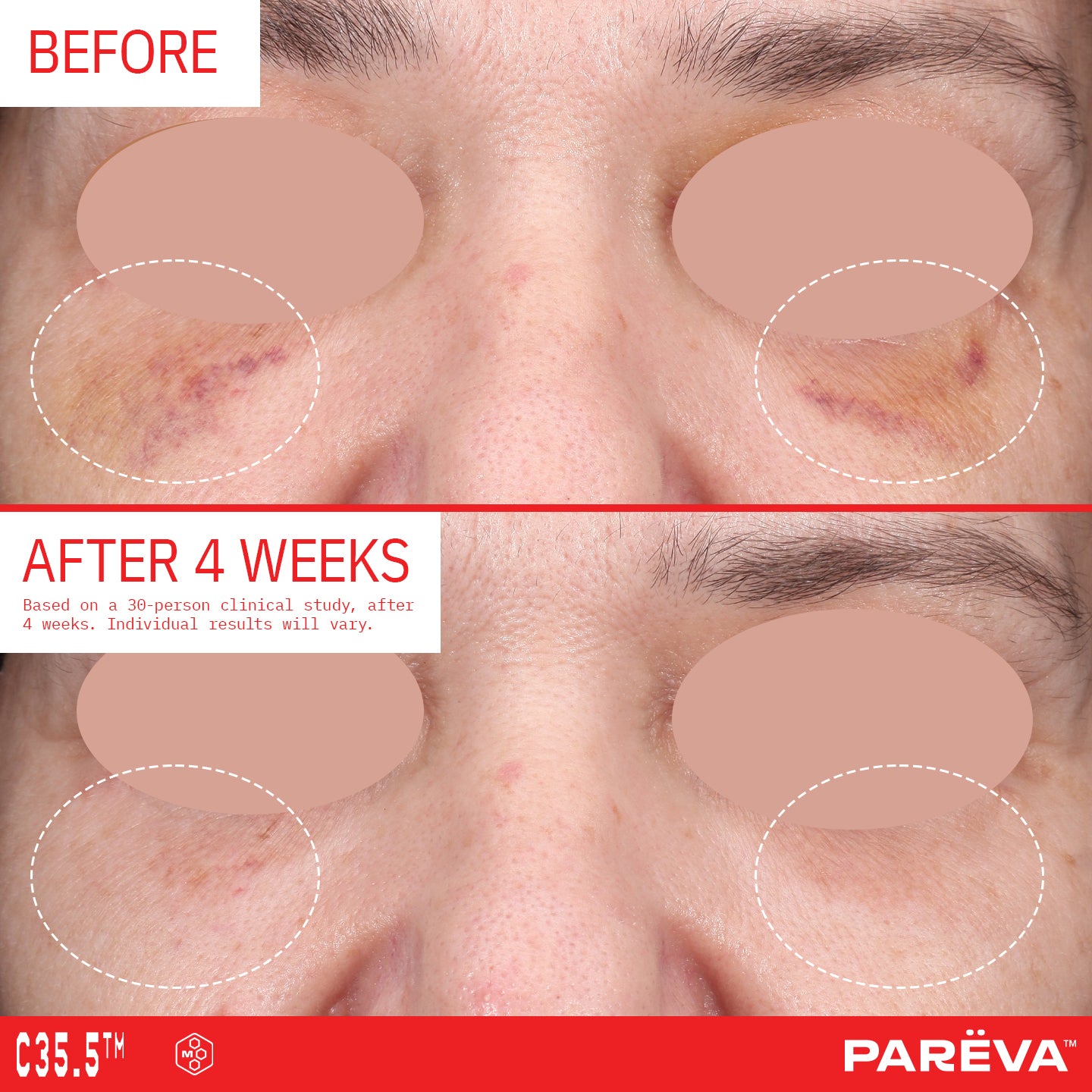C35.5™ Firming Glow Serum