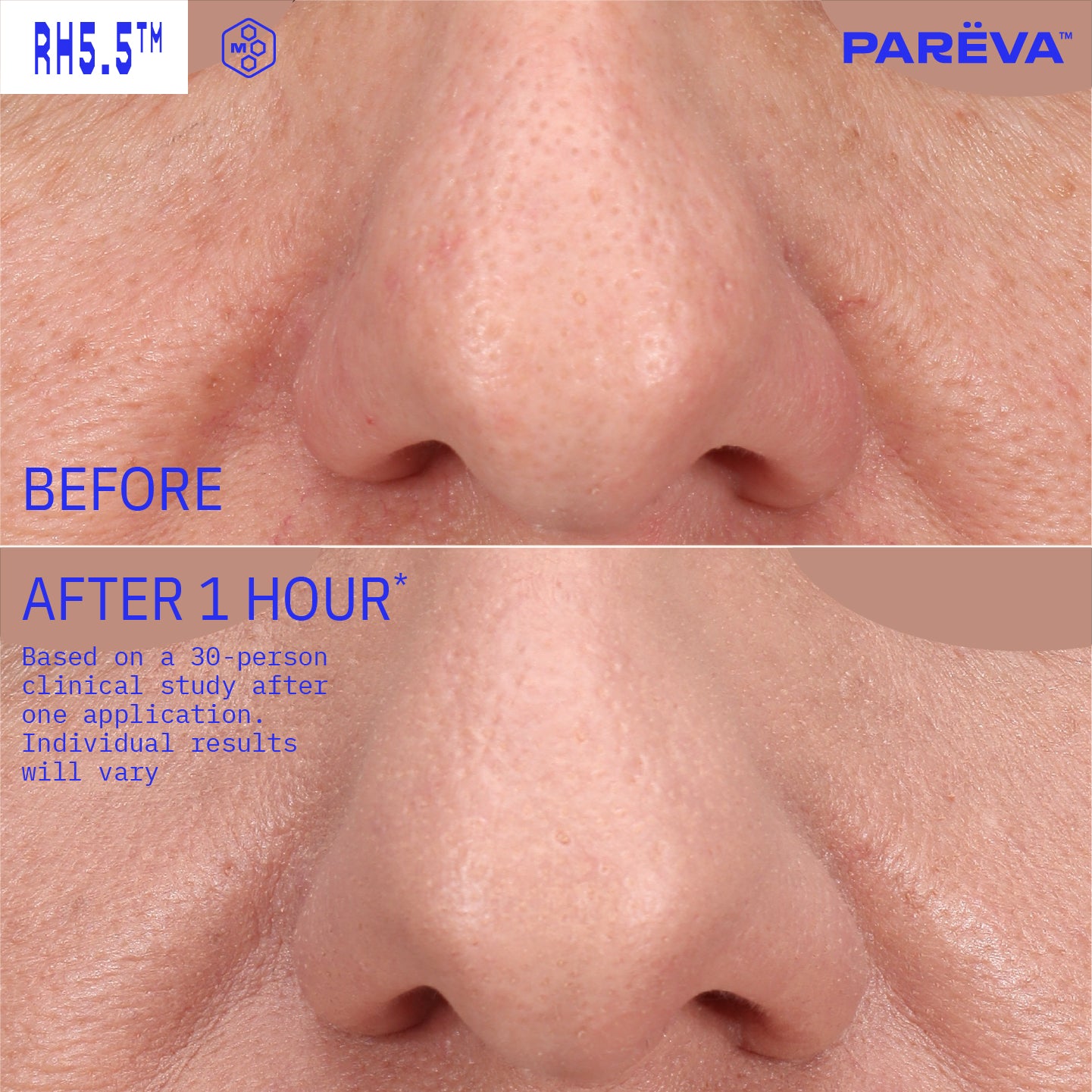 rh5.5_before_after_image