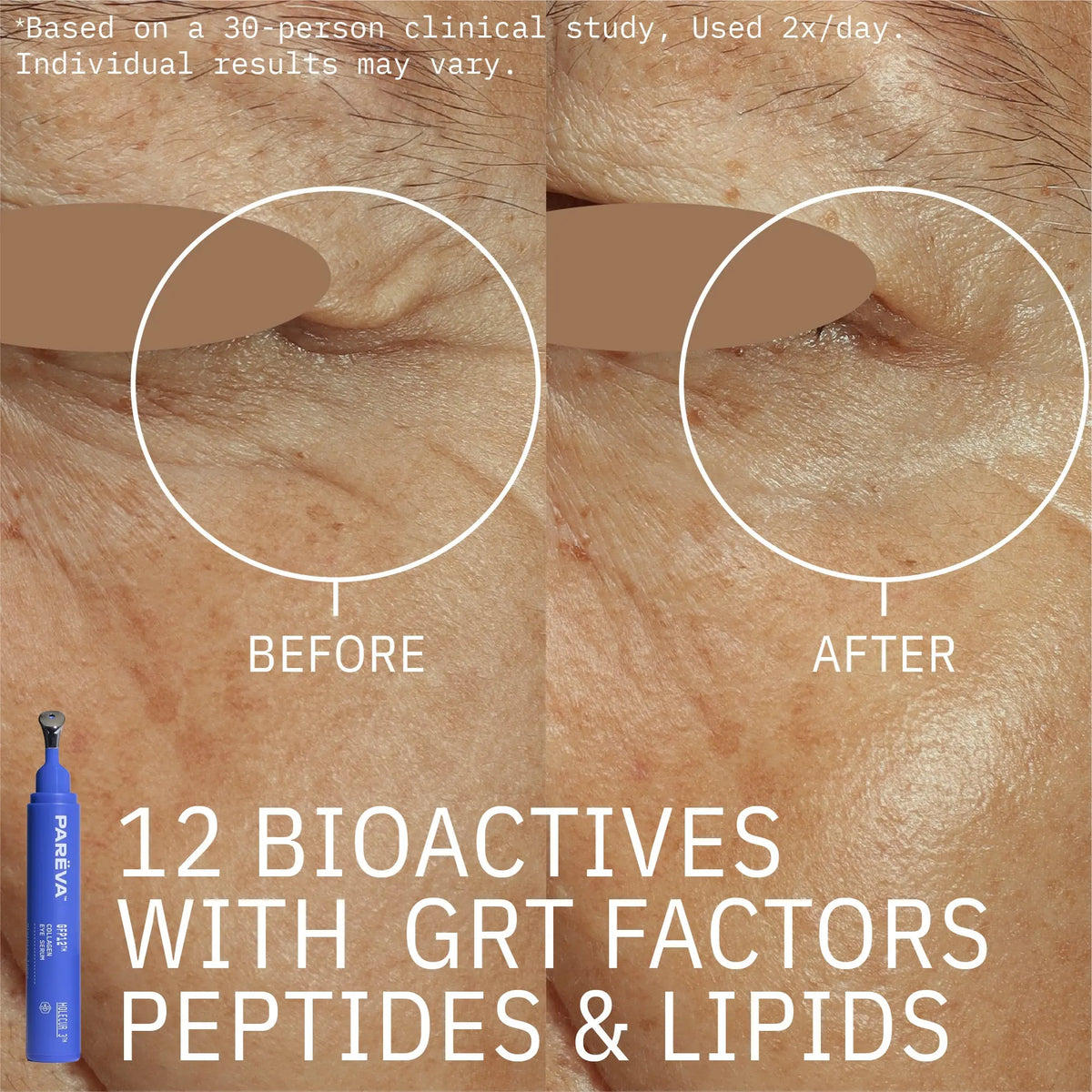 GFP12™ Collagen Eye Serum