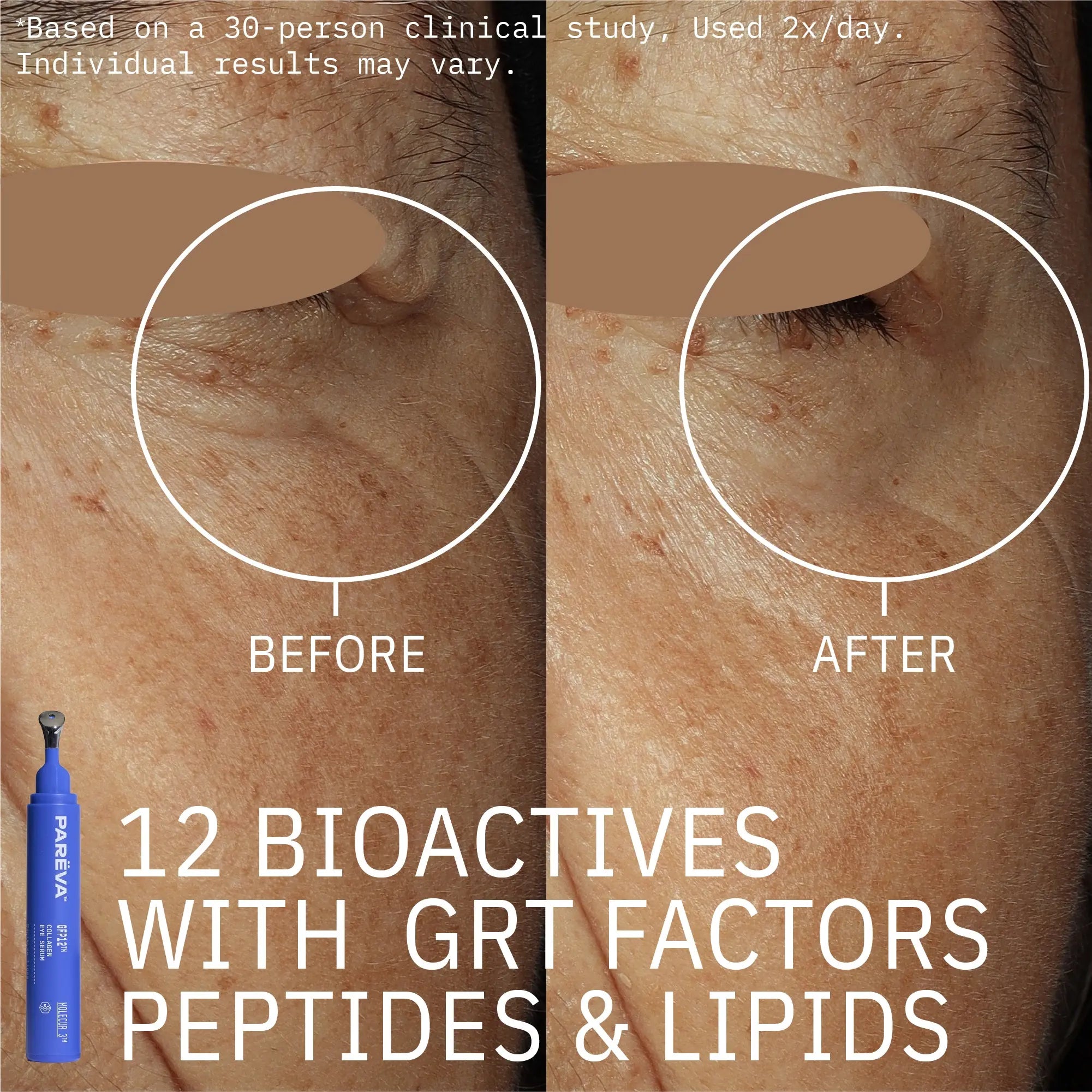 GFP12™ Collagen Eye Serum