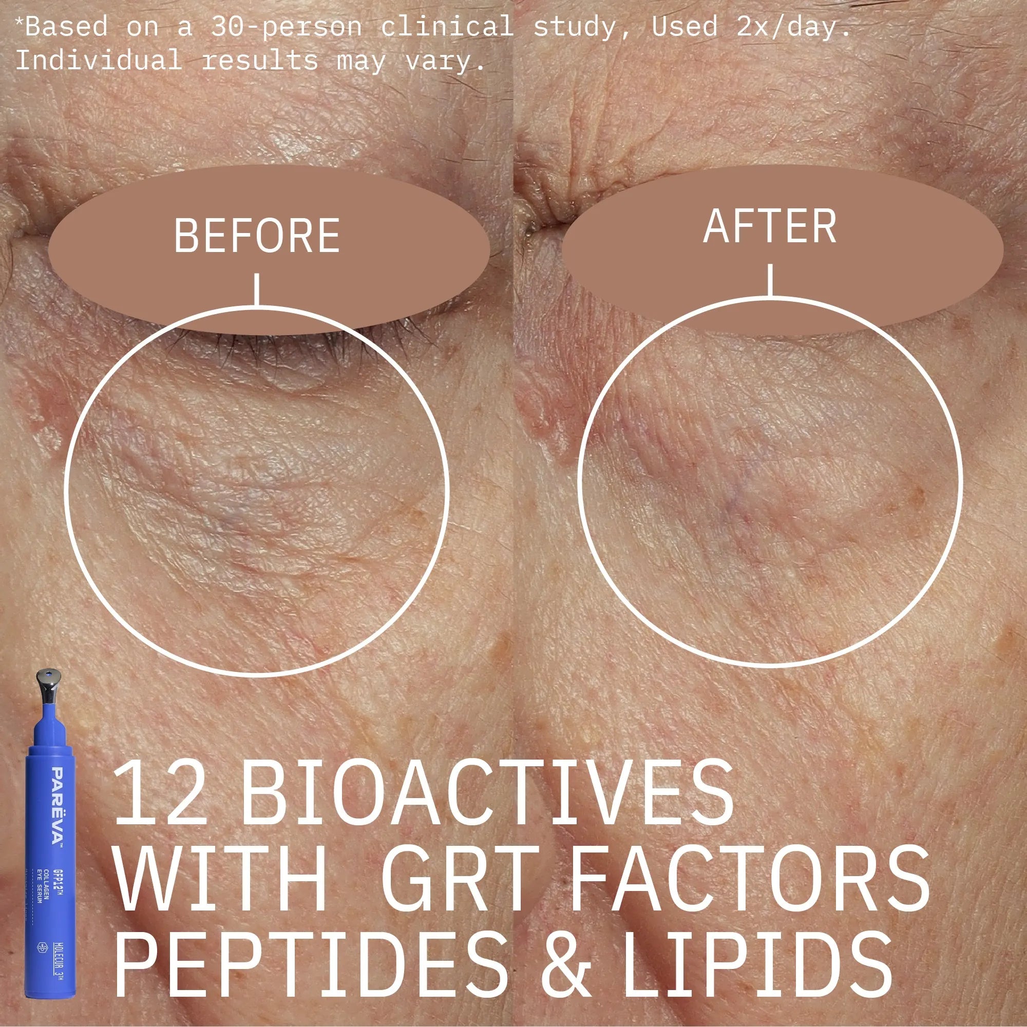GFP12™ Collagen Eye Serum