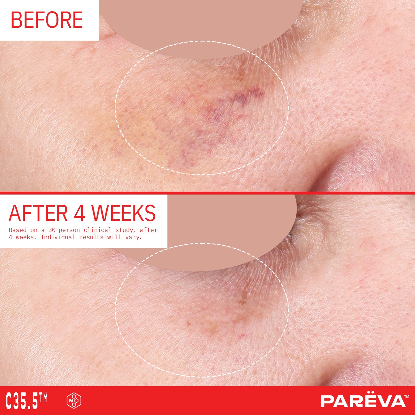 Discovery Set - Mighty Minis