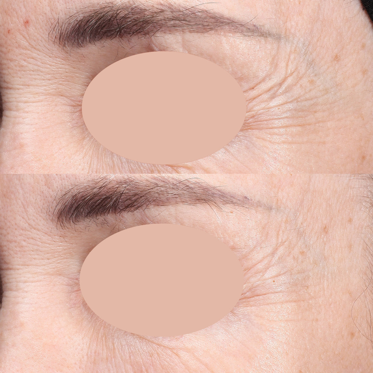 GFP12™ Collagen Eye Serum