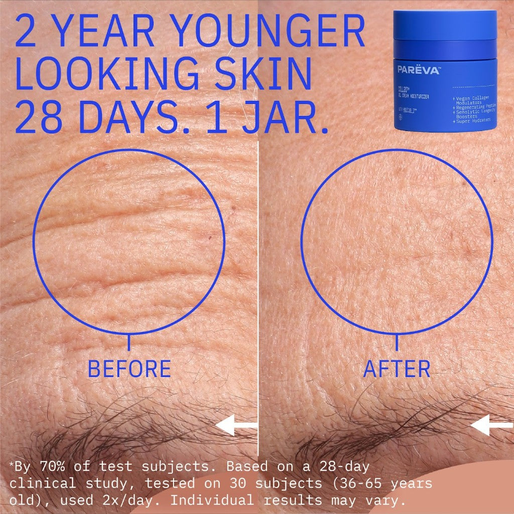 COLL20™ Gel Cream Moisturizer before and after forehead wrinkles